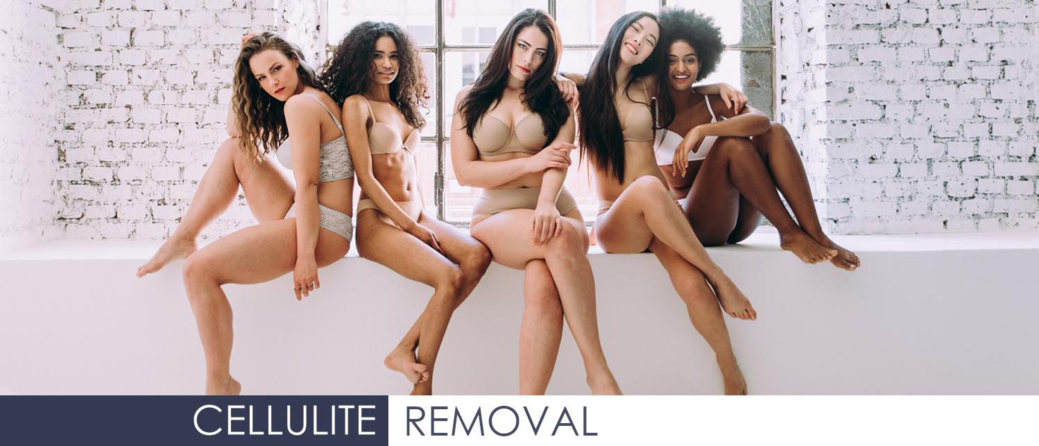 Cellulite removal