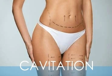 Cavitation Treatment