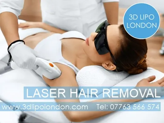 Laser Hair Removal London