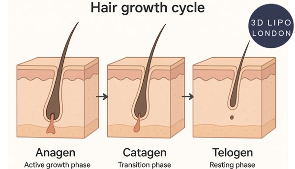 Hair growth cycle diagram showing anagen, catagen and telogen phases - why multiple laser sessions are needed
