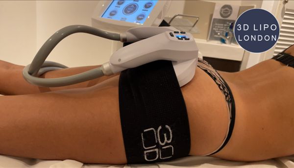 PowerSculpt electromagnetic technology treatment