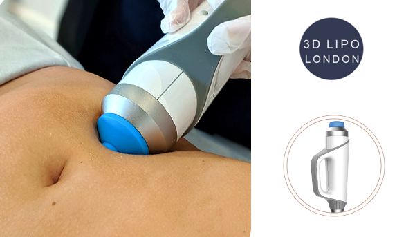 Shockwave therapy technology diagram showing acoustic wave treatment process for pain relief and cellulite reduction