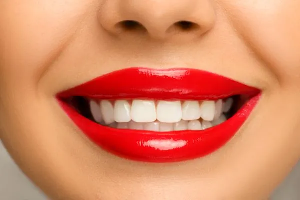 Hollywood teeth whitening treatment