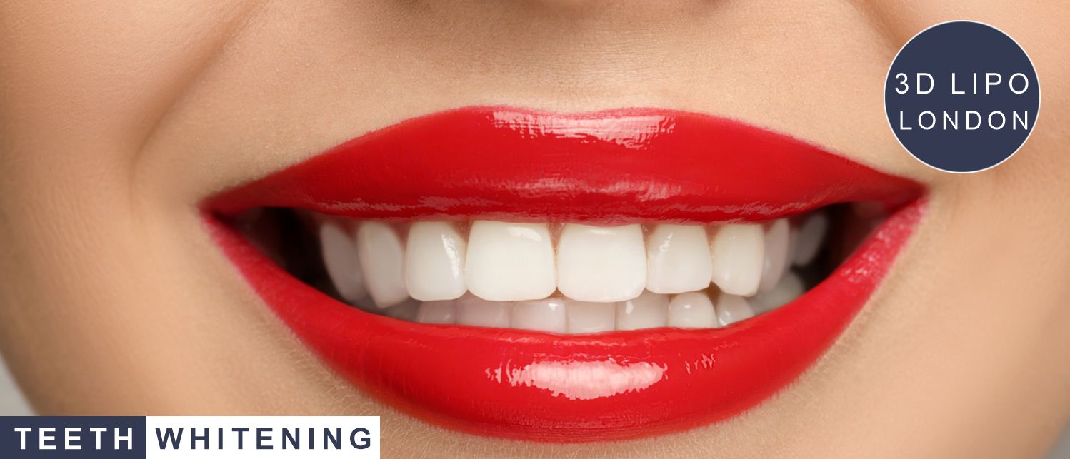 Professional teeth whitening treatment at 3D Lipo London - best teeth whitening clinic in Marylebone, Central London